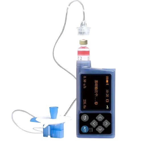 Insulin Pump | Smart Diabetes Management with App Support