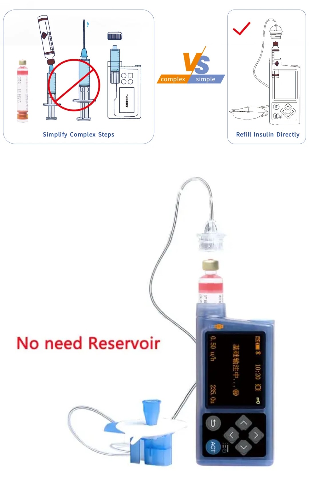 Insulin Pump | Smart Diabetes Management with App Support - Image 3